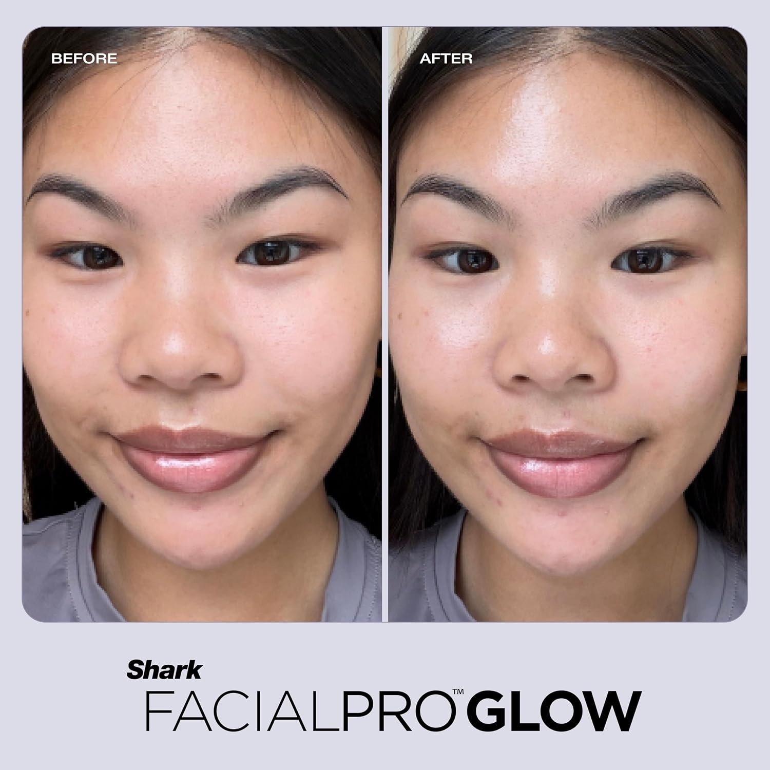 image:imageShark DePuffi Instant Contrast Therapy Tool Pink FH220PKFacialpro Glow Depuffi Lilac