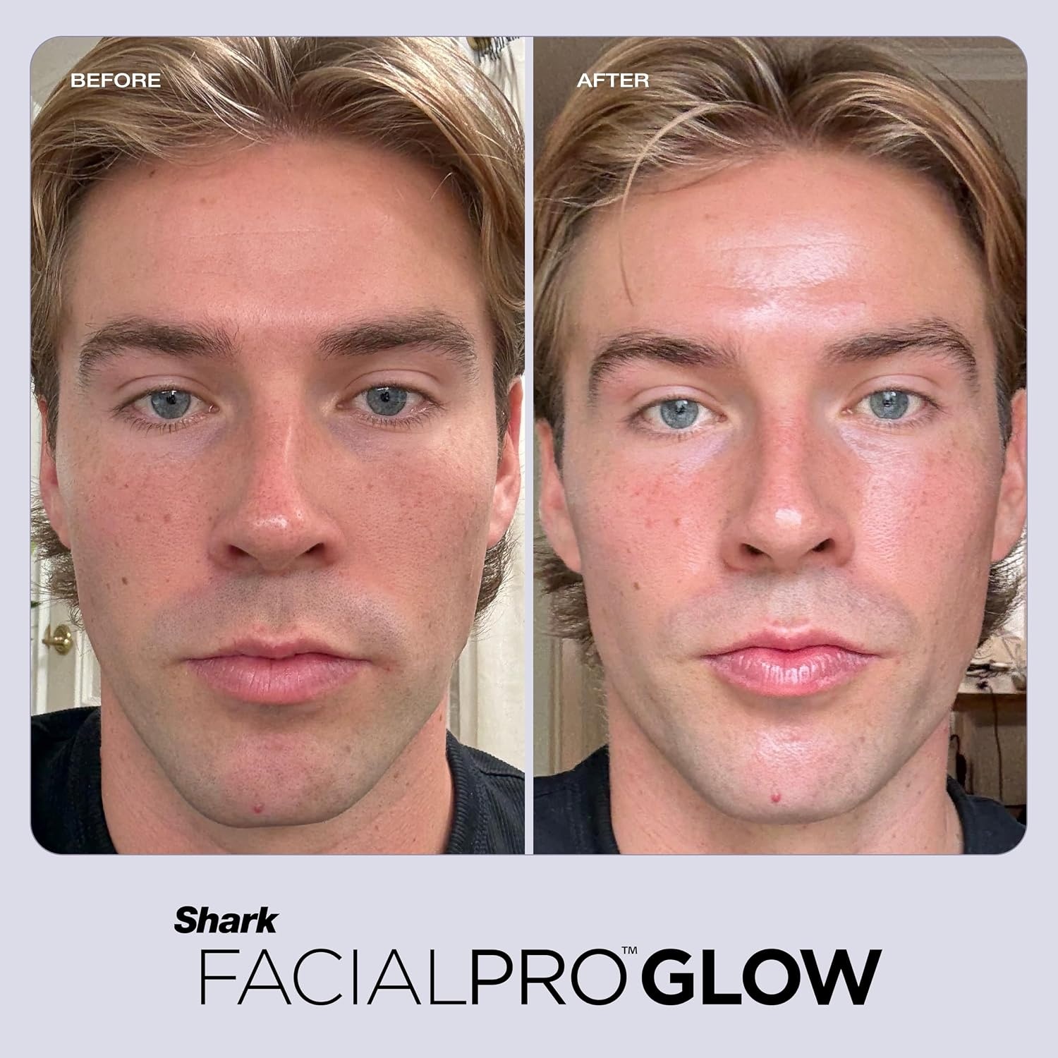 image:imageShark DePuffi Instant Contrast Therapy Tool Pink FH220PKFacialpro Glow Depuffi Lilac