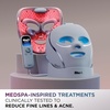 Shark CryoGlow LED Face Mask in Rose Glow, FW312PK(Lilac Chill)