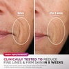 Shark CryoGlow LED Face Mask in Rose Glow, FW312PK(Lilac Chill)
