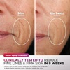 Shark CryoGlow LED Face Mask in Rose Glow, FW312PK(Rose Glow)